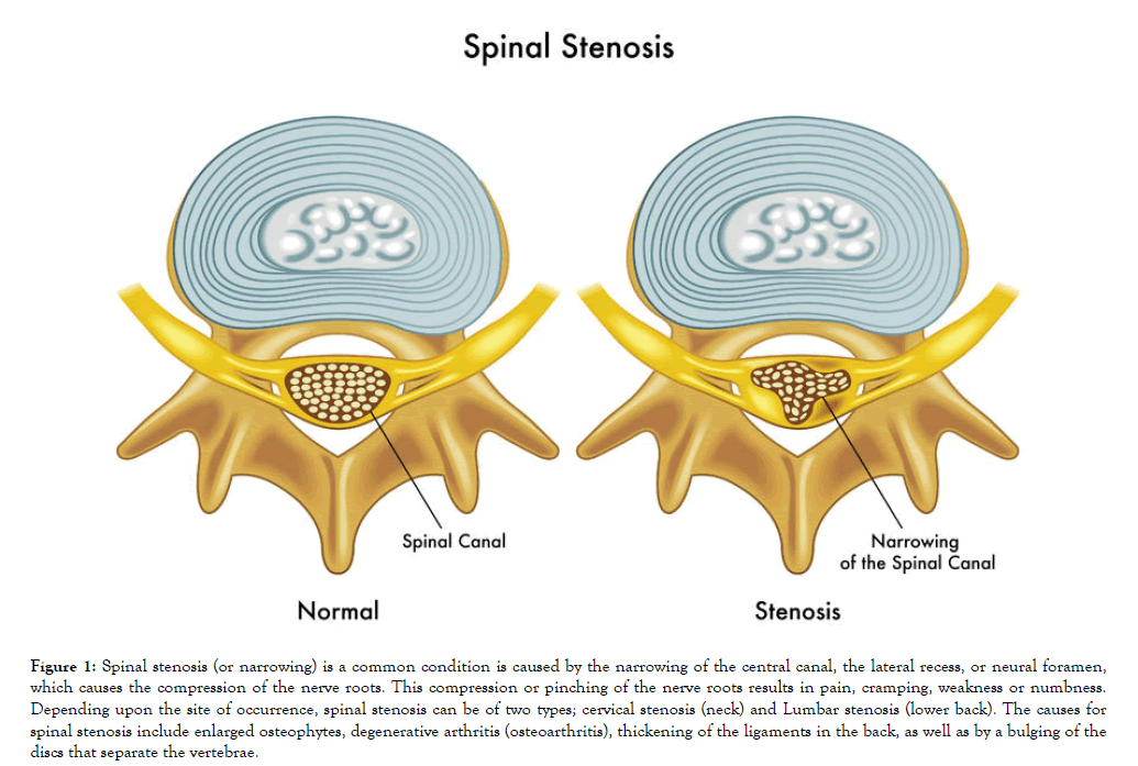 Bone-Research-cervical