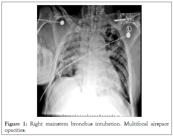 bronchus