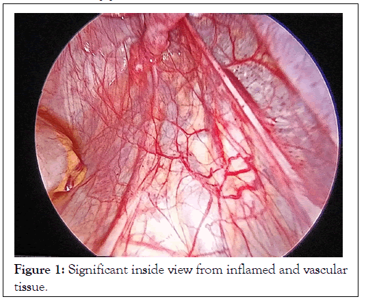 anesthesia-clinical-vascular