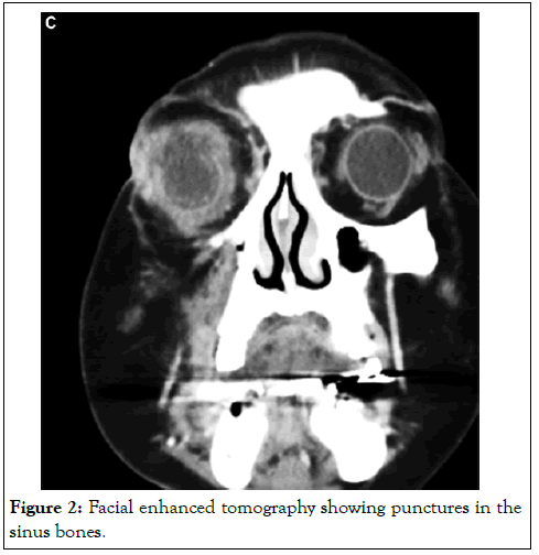 annals-essences-tomography