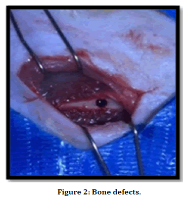 medical-dental-science-bone-defects