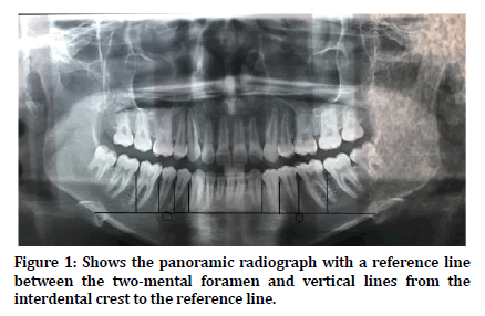 medical-dental-science-panoramic-radiograph