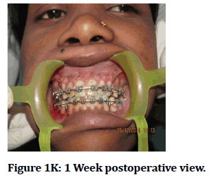 medical-dental-science-postoperative-view