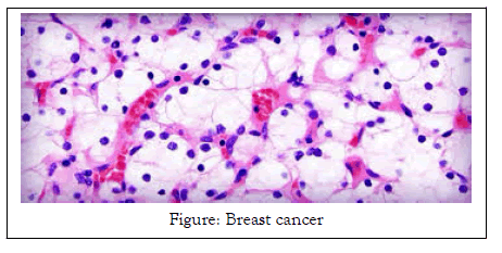 medical-surgical-breast