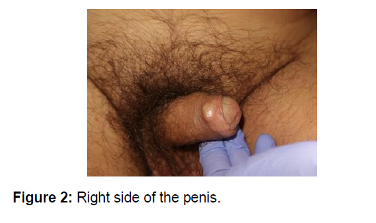 medical-surgical-urology-penis