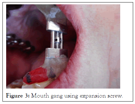 rheumatology-current-mouth