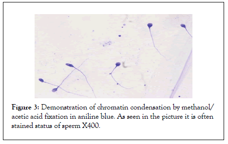 Andrology-condensation