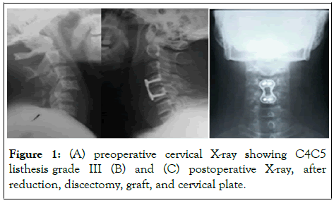 cervical