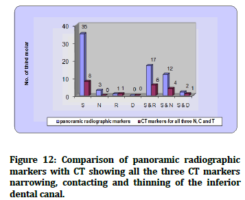 JRMDS-Comparison