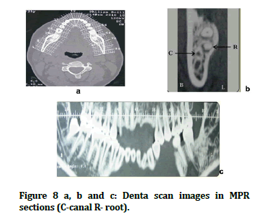 JRMDS-MPR