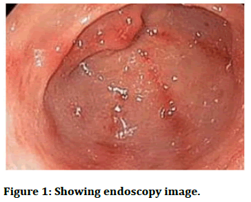 JRMDS-endoscopy