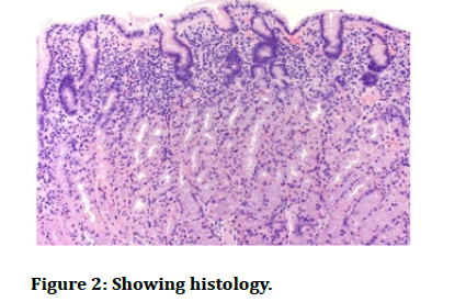 JRMDS-histology