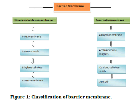 Jrmds-barrier