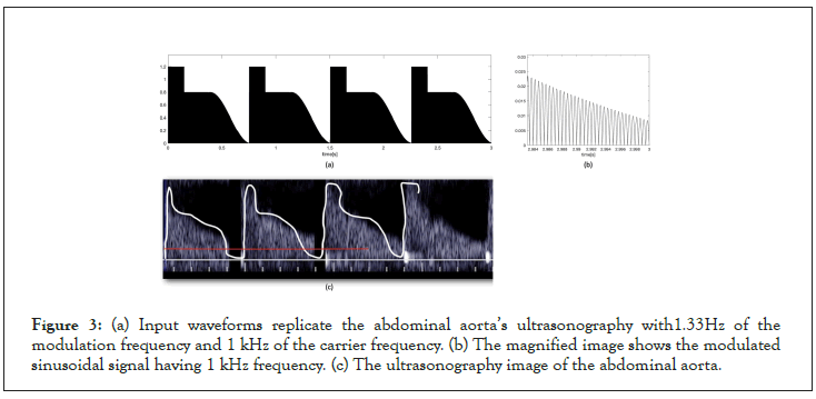 waveforms