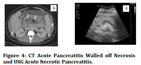 Medical-Pancreatitis