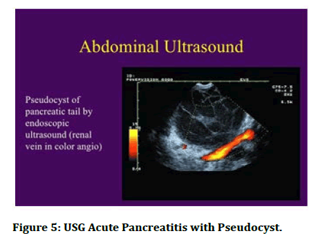 Medical-Pseudocyst