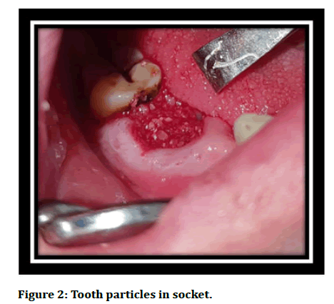 Medical-particles