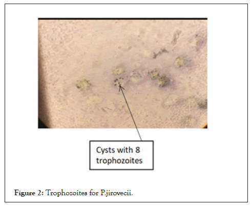 Trophozoites