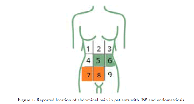 Women-Health-abdominal