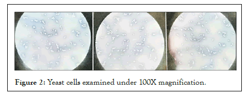 genomics-yeast