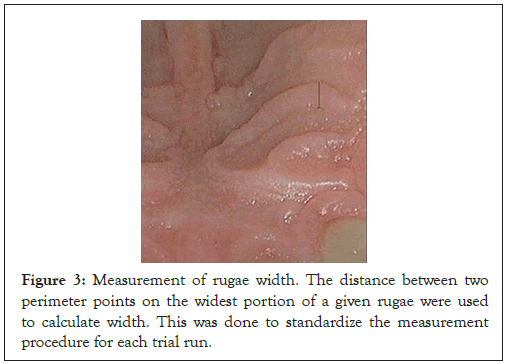 odontology-rugae-perimeter-points