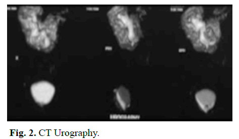 pediatric-urology-urography