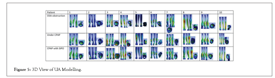 physical-medicine-Modelling