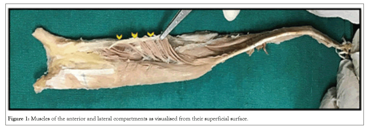 physical-medicine-compartments