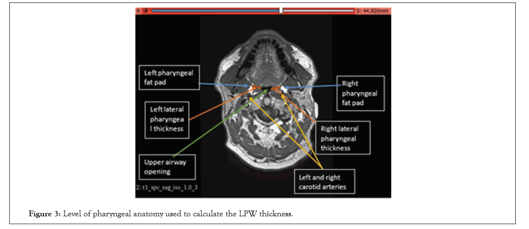 physical-medicine-pharyngeal