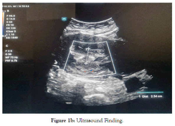 medical-dental-science-channel-fluorescence