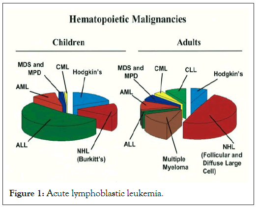 lymphoblastic