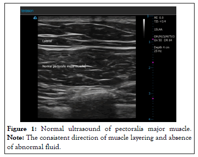 ultrasound