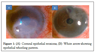 epithelial