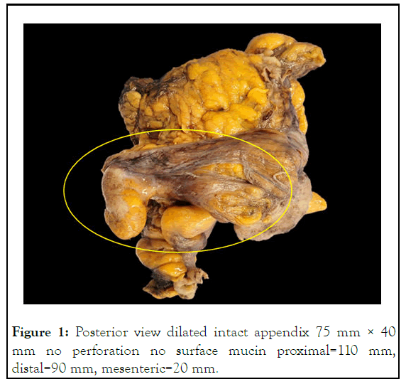 JCTR-Posterior