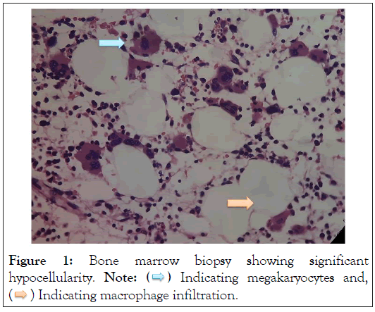 biopsy