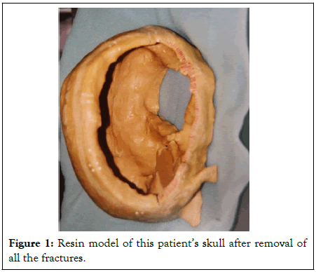 physical-medicine-model