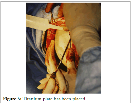 physical-medicine-plate