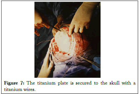 physical-medicine-wires