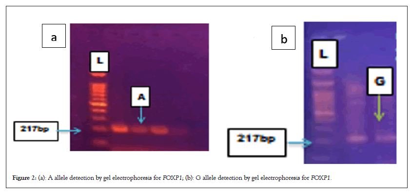 detection