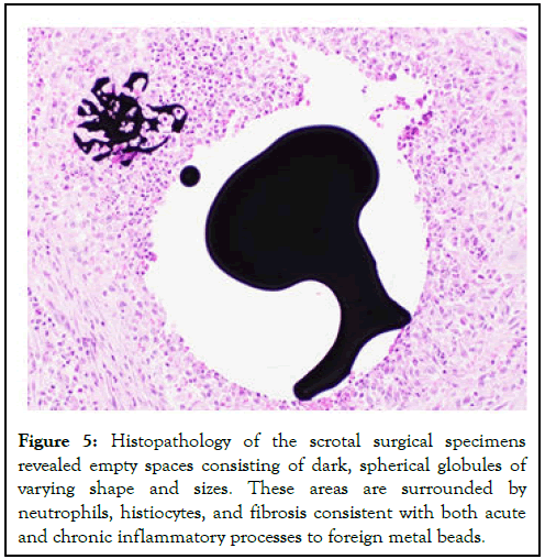 CPOA-scrotal