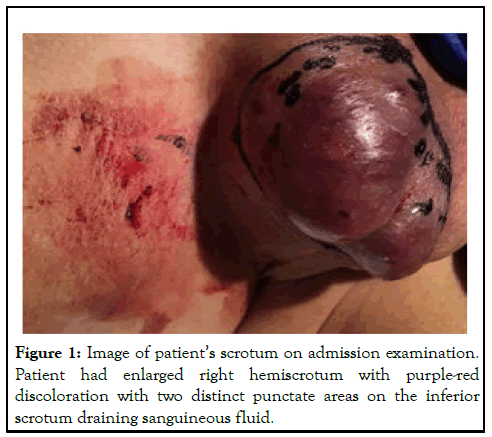 CPOA-scrotum