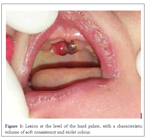 Lesion