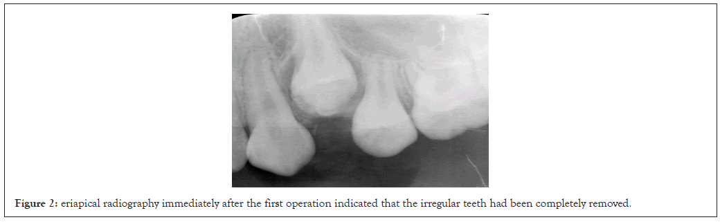 radiography