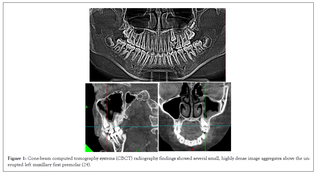 tomography