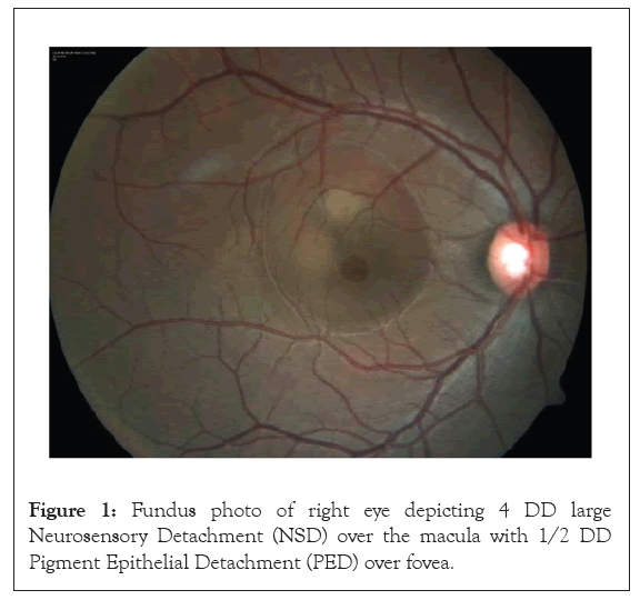 Fundus