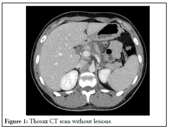 Thorax