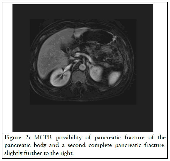 pancreatic