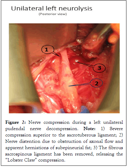 andrology-ligament