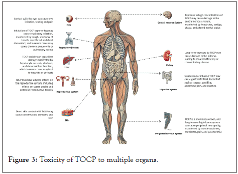 organs