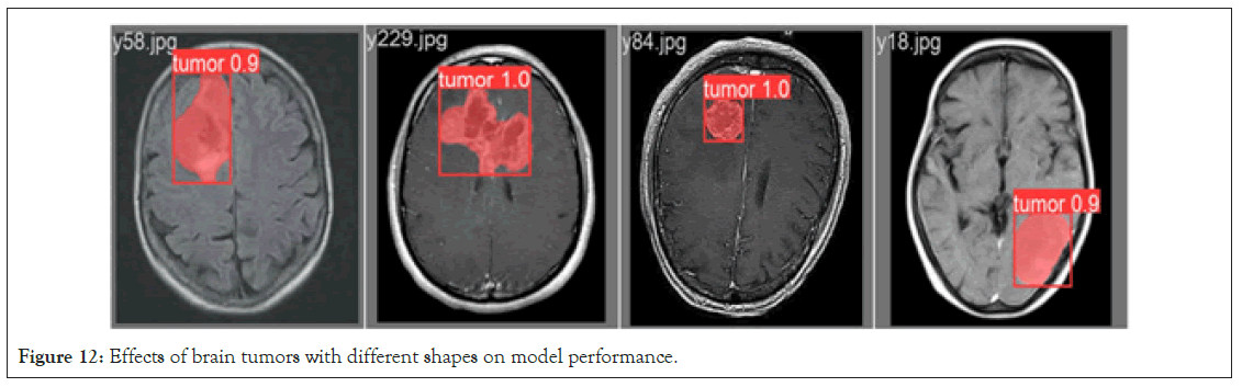 medical-model-performance